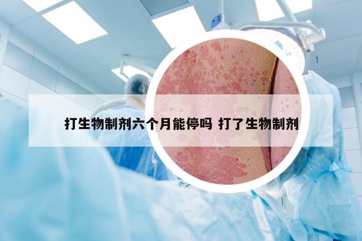 打生物制剂六个月能停吗 打了生物制剂