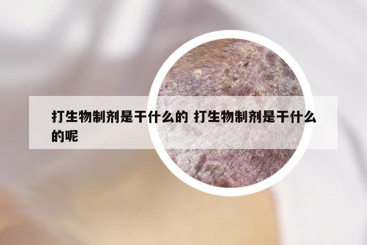 打生物制剂是干什么的 打生物制剂是干什么的呢