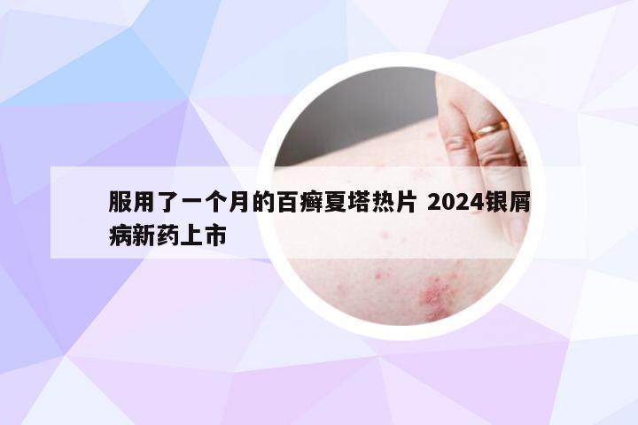 服用了一个月的百癣夏塔热片 2024银屑病新药上市