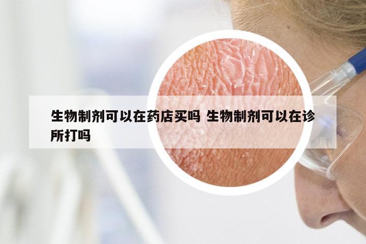 生物制剂可以在药店买吗 生物制剂可以在诊所打吗