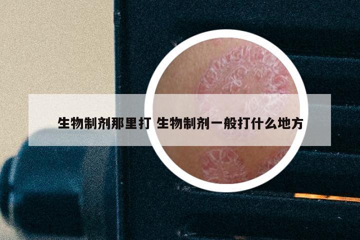 生物制剂那里打 生物制剂一般打什么地方