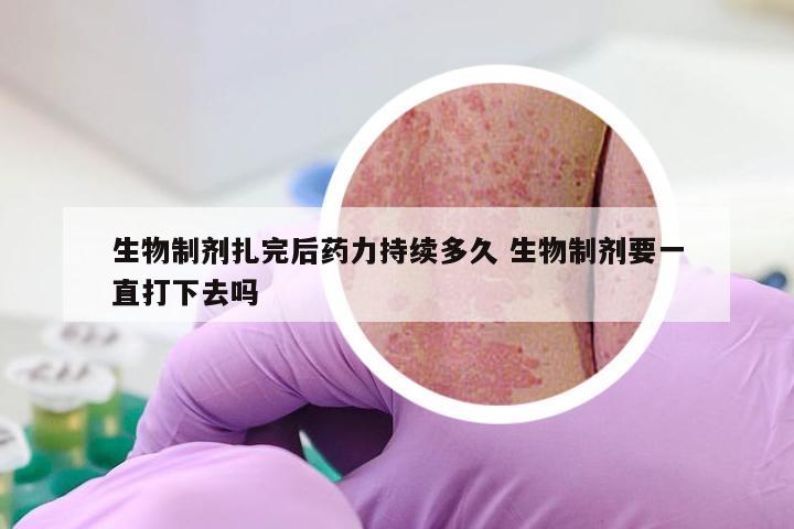 生物制剂扎完后药力持续多久 生物制剂要一直打下去吗