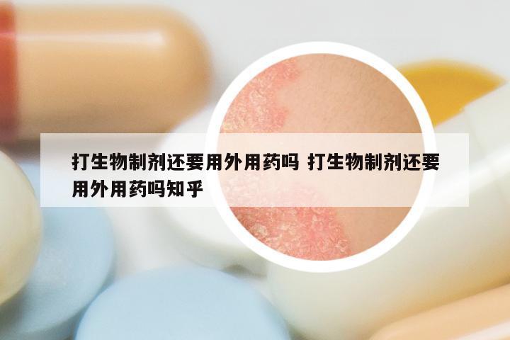 打生物制剂还要用外用药吗 打生物制剂还要用外用药吗知乎