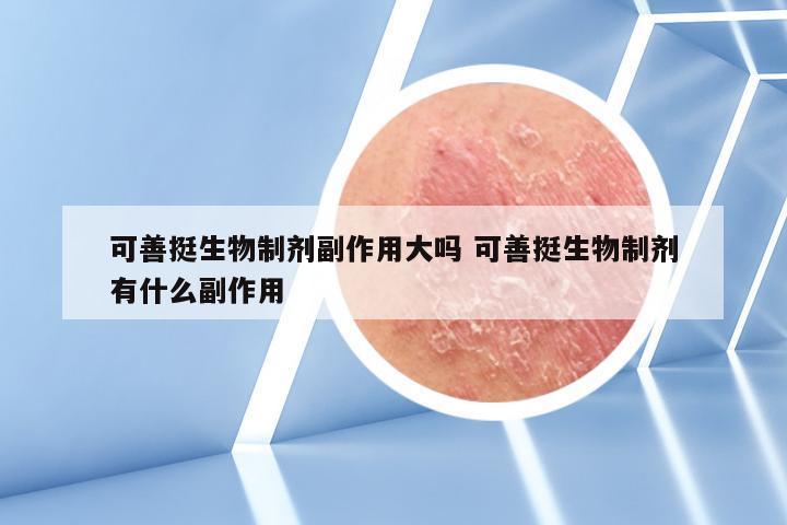 可善挺生物制剂副作用大吗 可善挺生物制剂有什么副作用