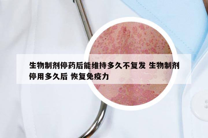 生物制剂停药后能维持多久不复发 生物制剂停用多久后 恢复免疫力