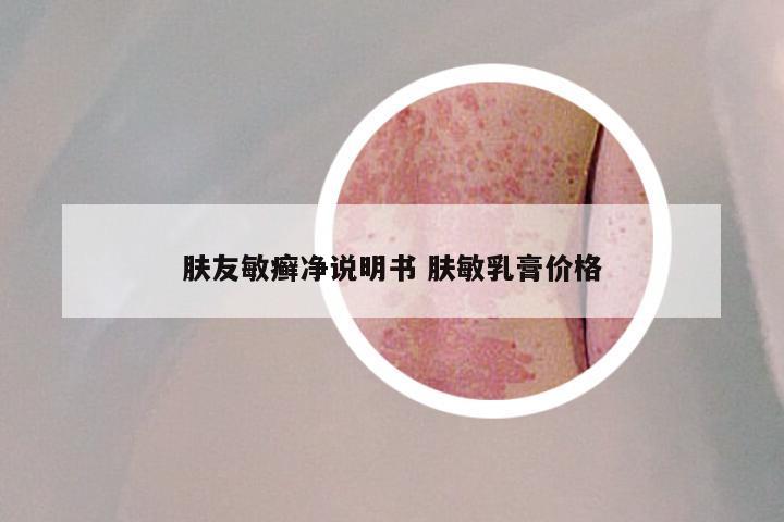 肤友敏癣净说明书 肤敏乳膏价格