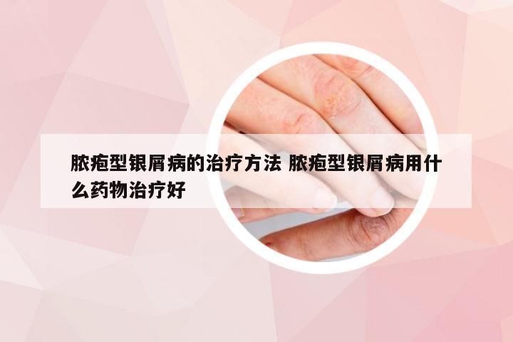 脓疱型银屑病的治疗方法 脓疱型银屑病用什么药物治疗好