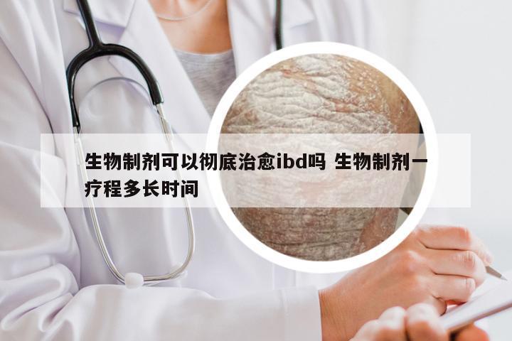 生物制剂可以彻底治愈ibd吗 生物制剂一疗程多长时间