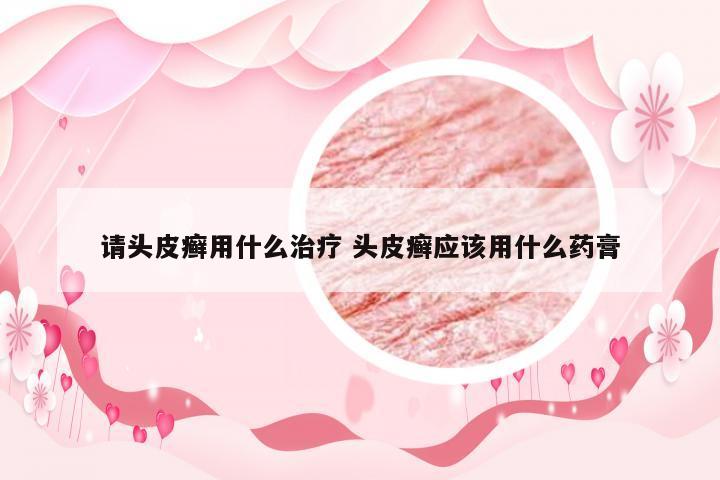 请头皮癣用什么治疗 头皮癣应该用什么药膏