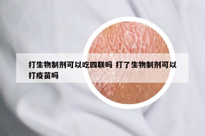 打生物制剂可以吃四联吗 打了生物制剂可以打疫苗吗