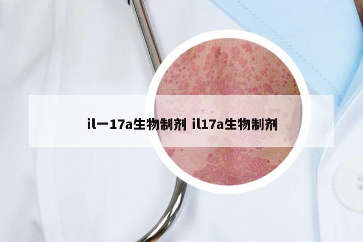 il一17a生物制剂 il17a生物制剂