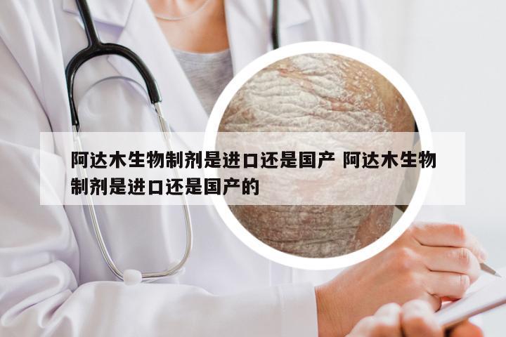 阿达木生物制剂是进口还是国产 阿达木生物制剂是进口还是国产的