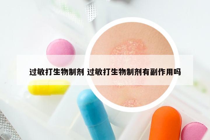 过敏打生物制剂 过敏打生物制剂有副作用吗