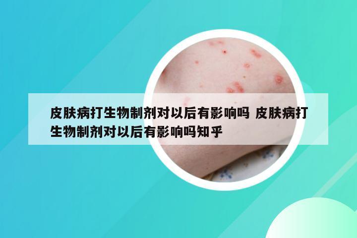 皮肤病打生物制剂对以后有影响吗 皮肤病打生物制剂对以后有影响吗知乎