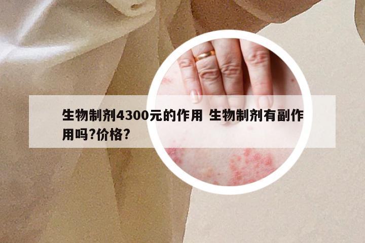 生物制剂4300元的作用 生物制剂有副作用吗?价格?