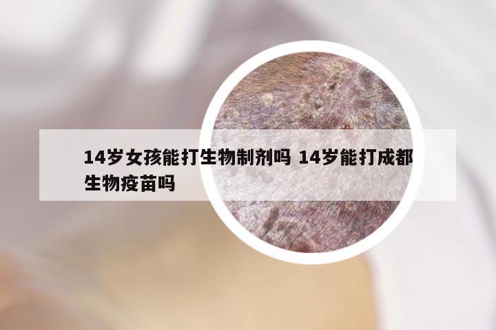 14岁女孩能打生物制剂吗 14岁能打成都生物疫苗吗