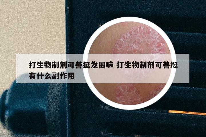 打生物制剂可善挺发困嘛 打生物制剂可善挺有什么副作用