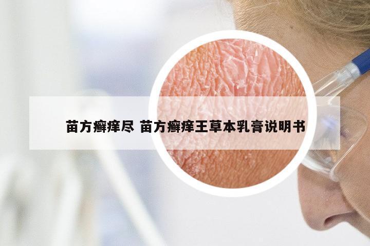 苗方癣痒尽 苗方癣痒王草本乳膏说明书