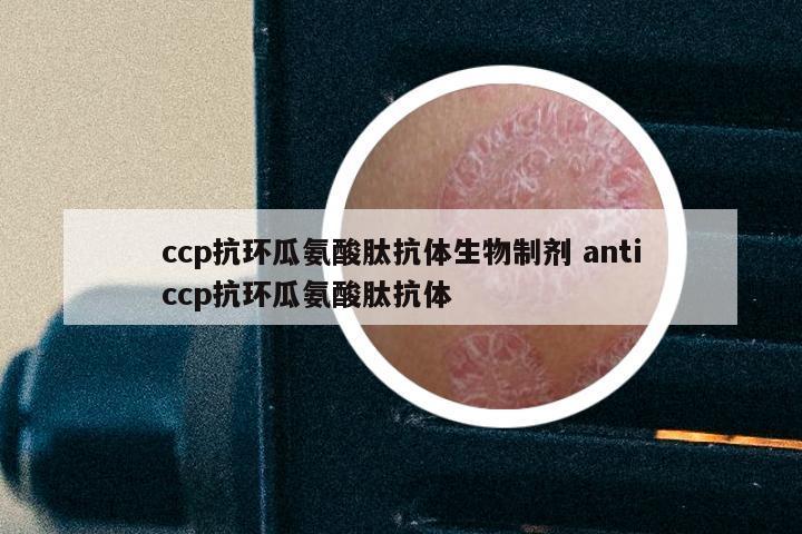 ccp抗环瓜氨酸肽抗体生物制剂 anticcp抗环瓜氨酸肽抗体