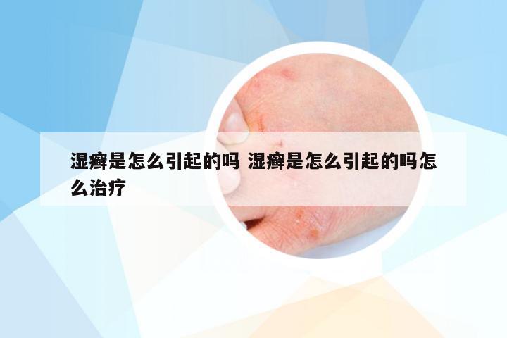 湿癣是怎么引起的吗 湿癣是怎么引起的吗怎么治疗