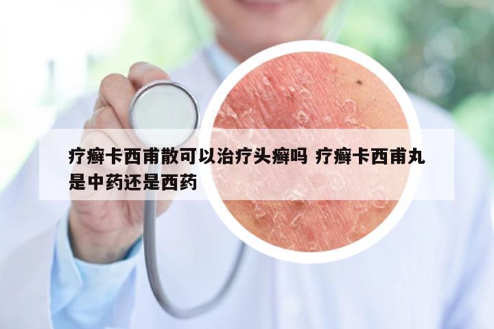 疗癣卡西甫散可以治疗头癣吗 疗癣卡西甫丸是中药还是西药