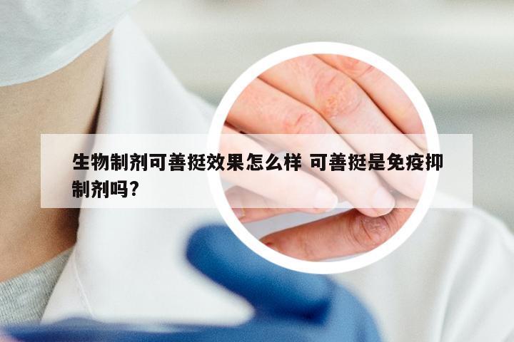 生物制剂可善挺效果怎么样 可善挺是免疫抑制剂吗?