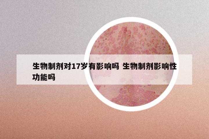 生物制剂对17岁有影响吗 生物制剂影响性功能吗