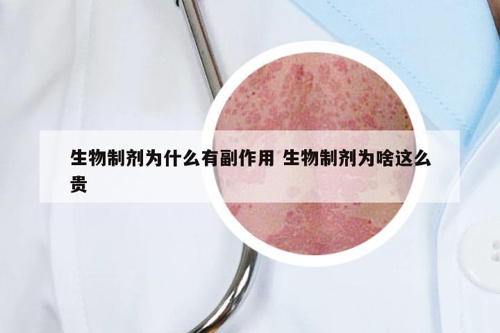 生物制剂为什么有副作用 生物制剂为啥这么贵