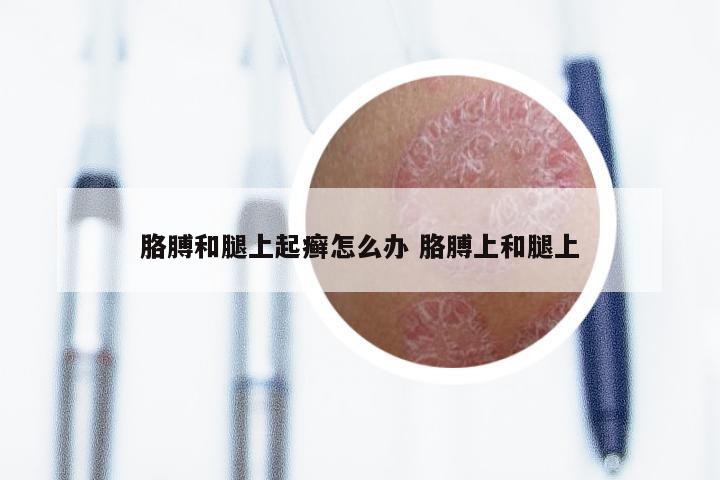 胳膊和腿上起癣怎么办 胳膊上和腿上