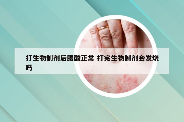 打生物制剂后腰酸正常 打完生物制剂会发烧吗