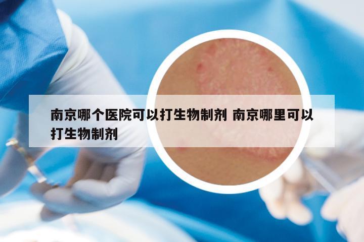 南京哪个医院可以打生物制剂 南京哪里可以打生物制剂