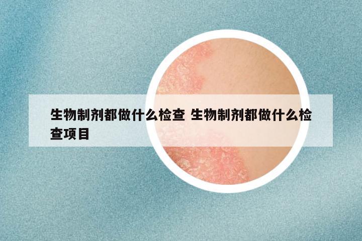 生物制剂都做什么检查 生物制剂都做什么检查项目