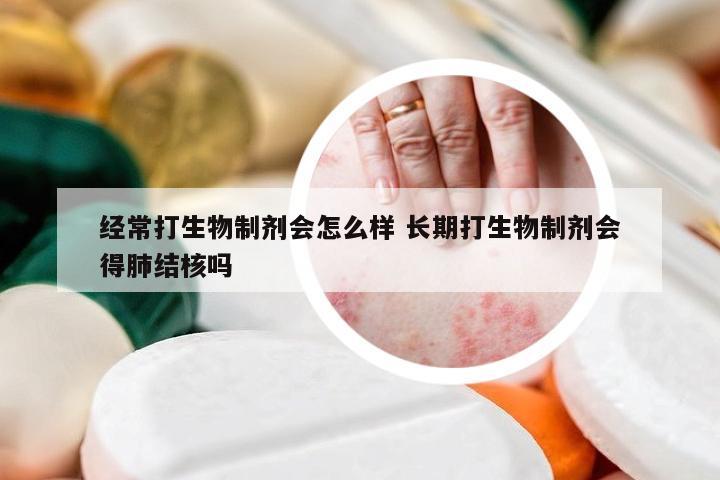 经常打生物制剂会怎么样 长期打生物制剂会得肺结核吗