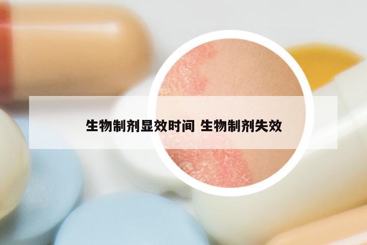 生物制剂显效时间 生物制剂失效