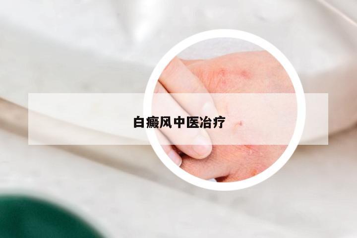 白癜风中医冶疗