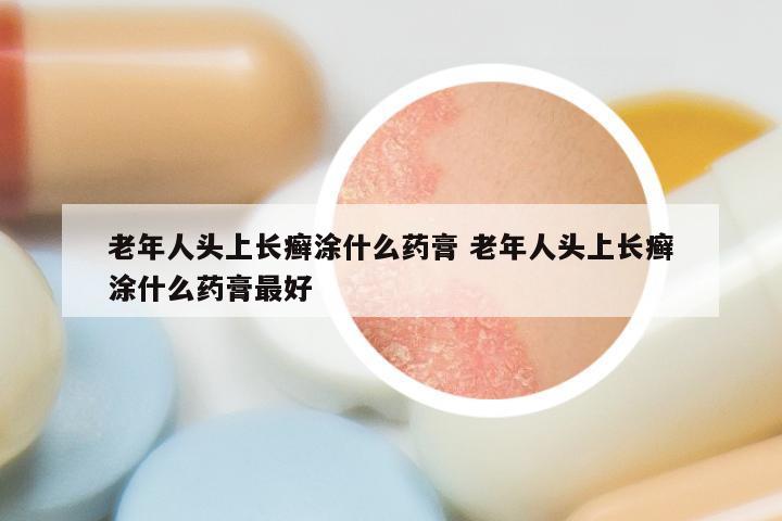 老年人头上长癣涂什么药膏 老年人头上长癣涂什么药膏最好