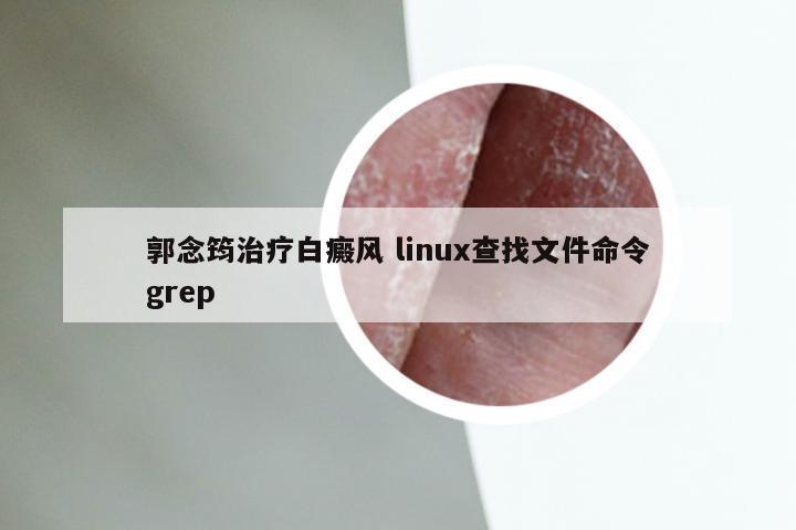 郭念筠治疗白癜风 linux查找文件命令grep