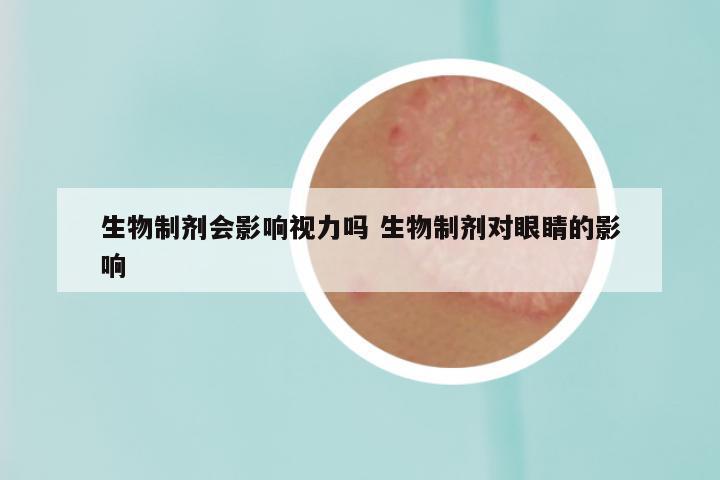 生物制剂会影响视力吗 生物制剂对眼睛的影响