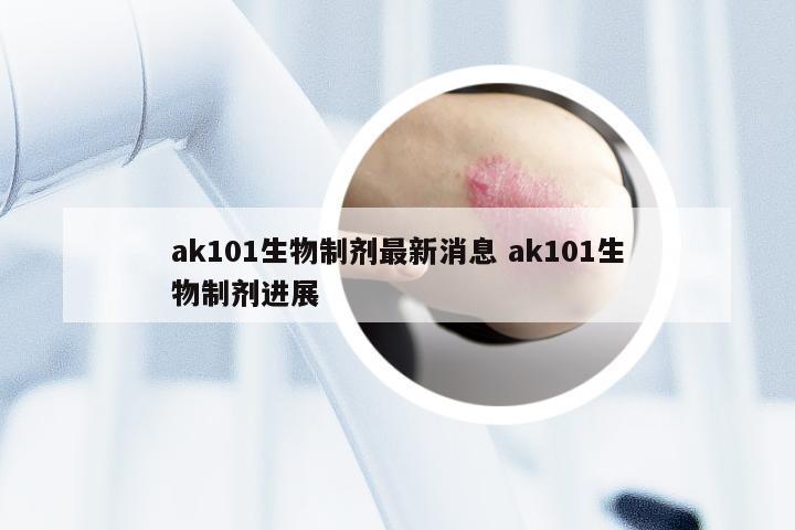 ak101生物制剂最新消息 ak101生物制剂进展