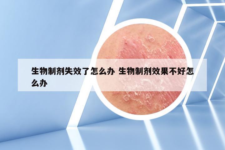 生物制剂失效了怎么办 生物制剂效果不好怎么办