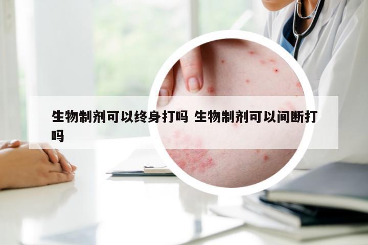 生物制剂可以终身打吗 生物制剂可以间断打吗