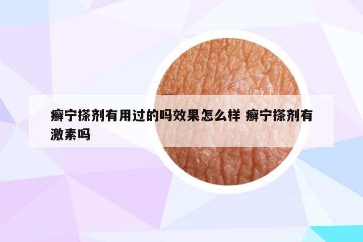 癣宁搽剂有用过的吗效果怎么样 癣宁搽剂有激素吗