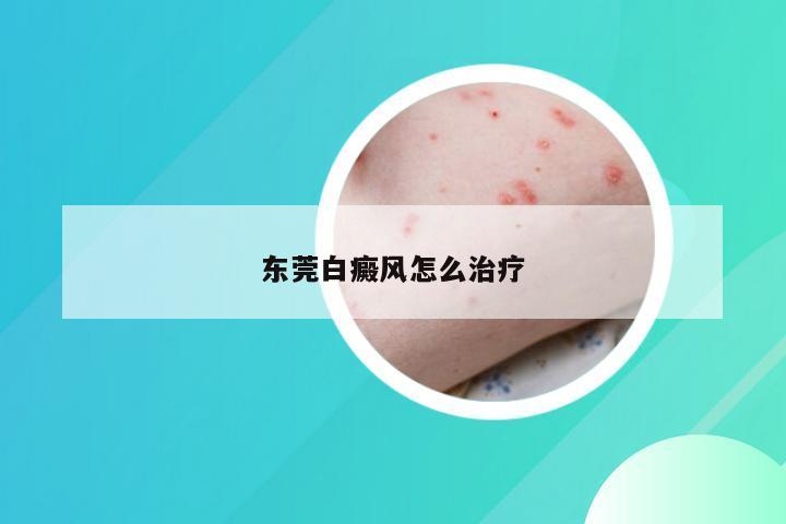 东莞白癜风怎么治疗