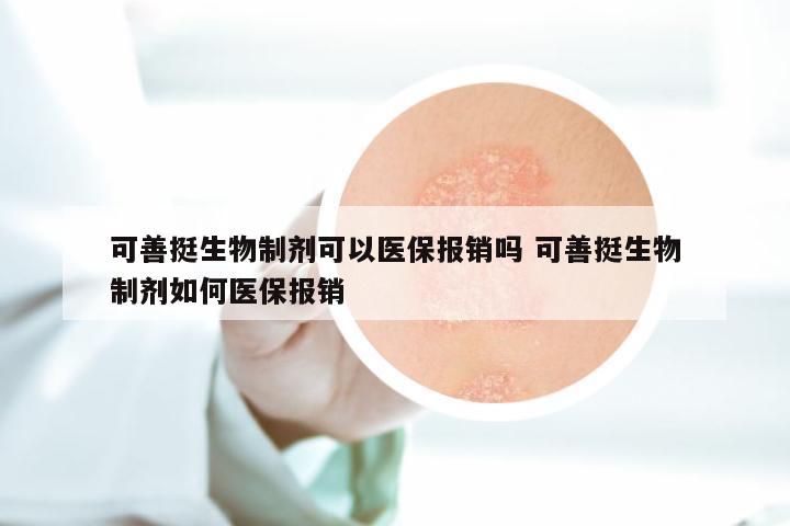 可善挺生物制剂可以医保报销吗 可善挺生物制剂如何医保报销