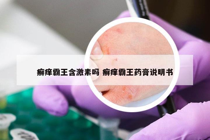 癣痒霸王含激素吗 癣痒霸王药膏说明书