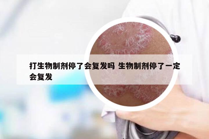 打生物制剂停了会复发吗 生物制剂停了一定会复发