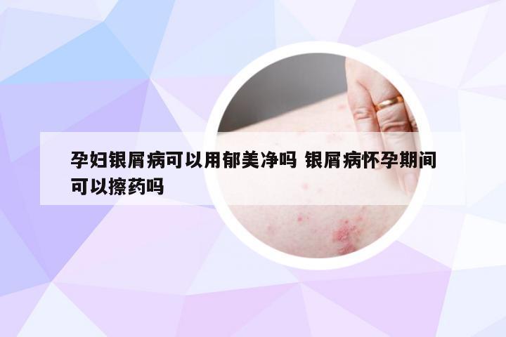 孕妇银屑病可以用郁美净吗 银屑病怀孕期间可以擦药吗