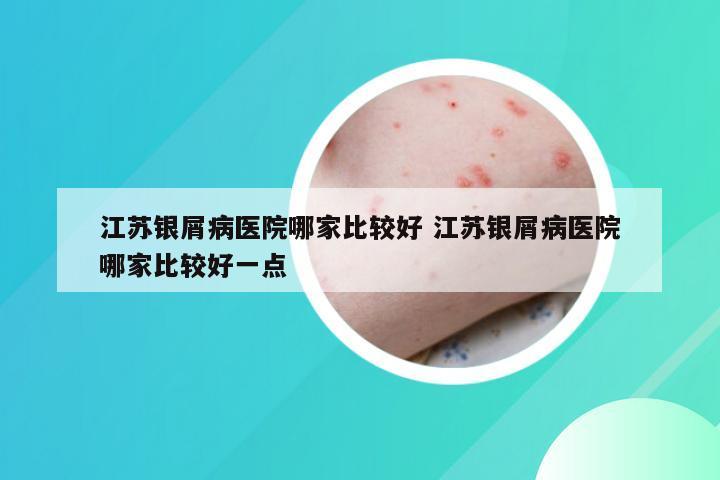 江苏银屑病医院哪家比较好 江苏银屑病医院哪家比较好一点