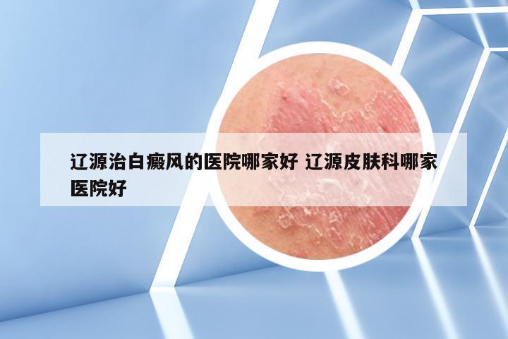 辽源治白癜风的医院哪家好 辽源皮肤科哪家医院好