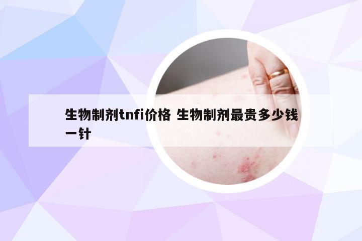 生物制剂tnfi价格 生物制剂最贵多少钱一针